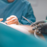 What to Know About How Wounds Are Closed