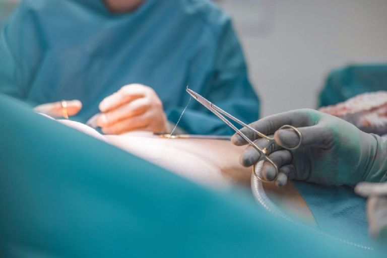 What to Know About How Wounds Are Closed