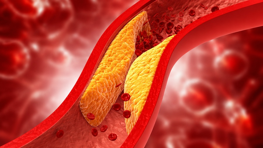 how to lower blood pressure naturally